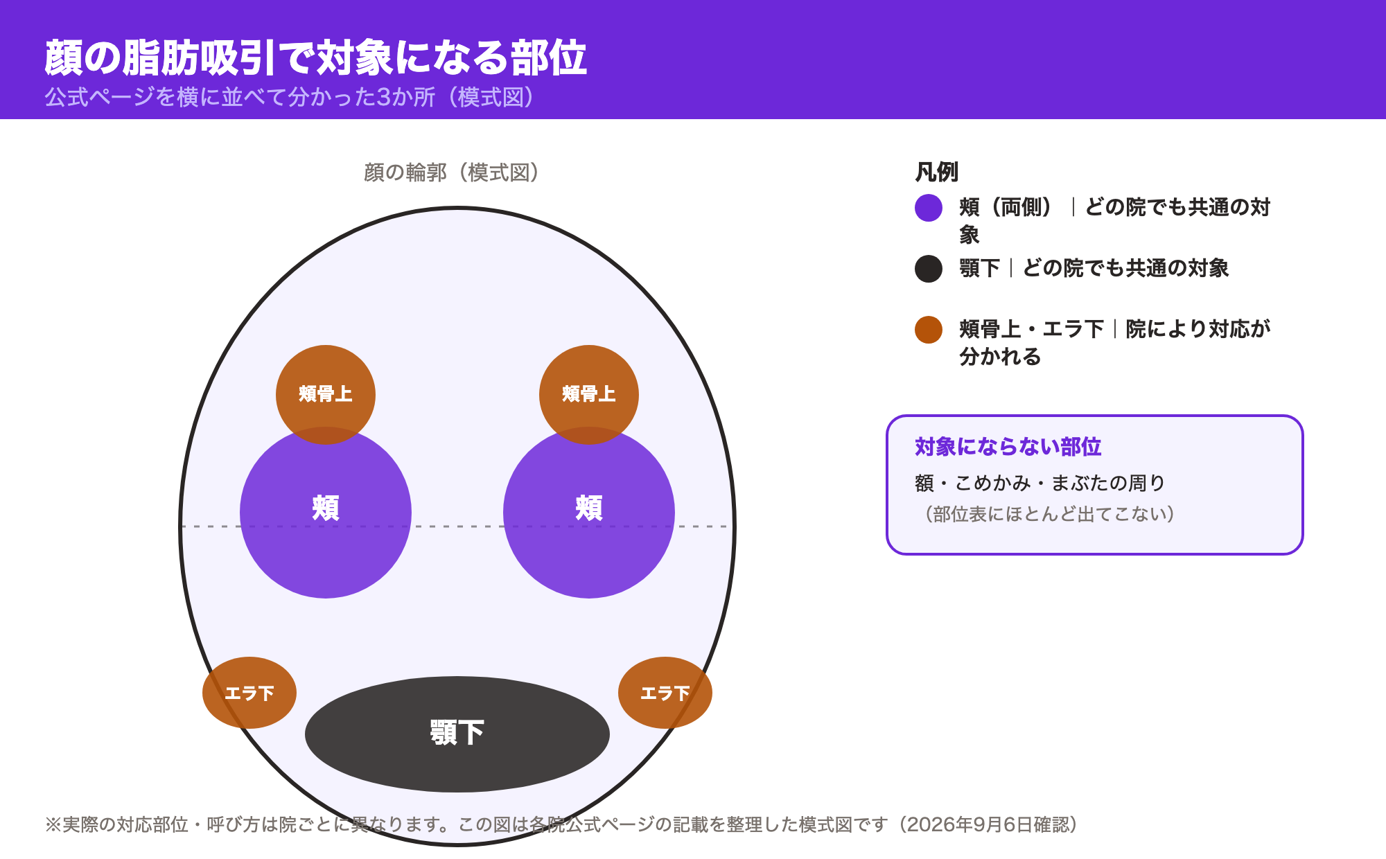 顔の脂肪吸引で吸引対象になる部位を示した模式図。頬・顎下はどの院でも共通の対象、頬骨上・エラ下は院により対応が分かれる