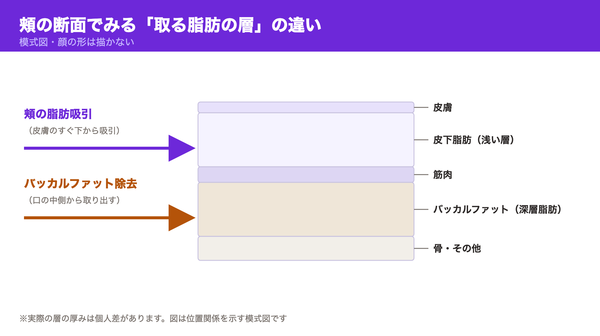 頬の断面を模式化し、頬の脂肪吸引が届く皮下脂肪の層とバッカルファット除去が届く深層脂肪の層の位置関係を示した図