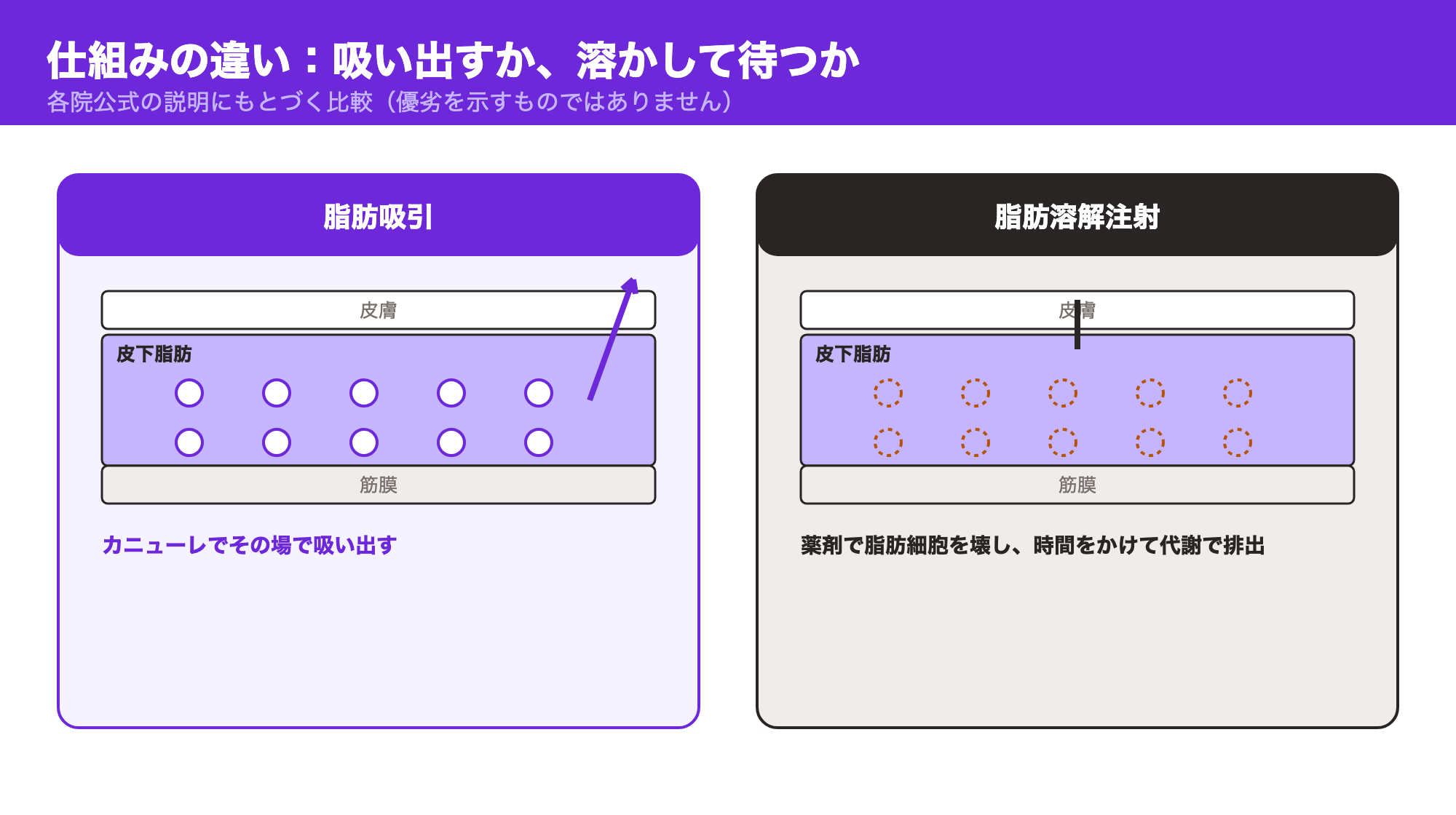 脂肪吸引はカニューレでその場で脂肪を吸い出し、脂肪溶解注射は薬剤で脂肪細胞を壊して時間をかけて代謝で排出することを示した皮下脂肪の層の図