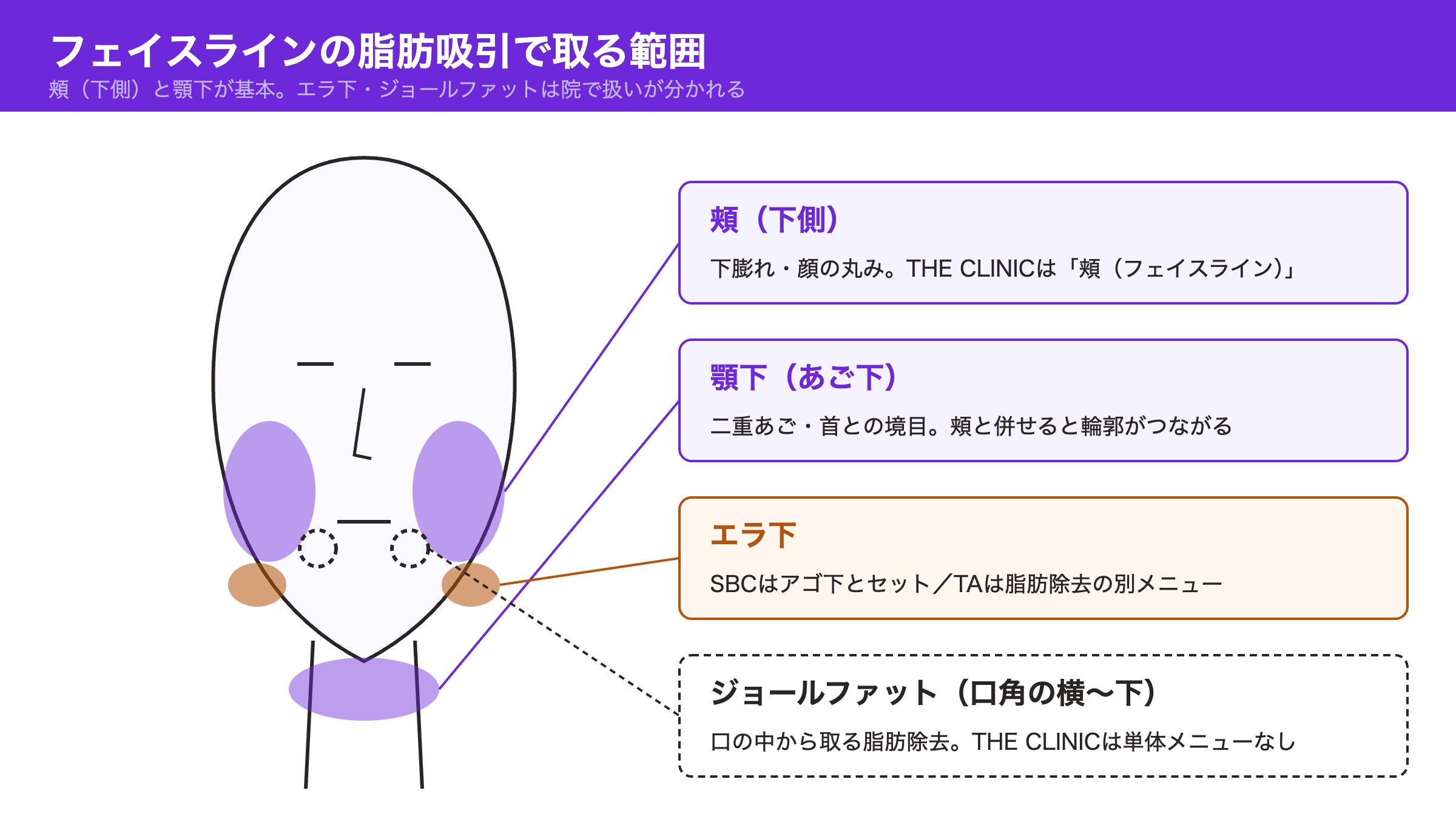 フェイスラインの脂肪吸引で取る範囲の図。頬の下側と顎下が基本で、エラ下は湘南美容クリニックではアゴ下とセット、TAクリニックでは脂肪除去の別メニュー。ジョールファットは口の中から取る脂肪除去で、THE CLINICには単体メニューがない